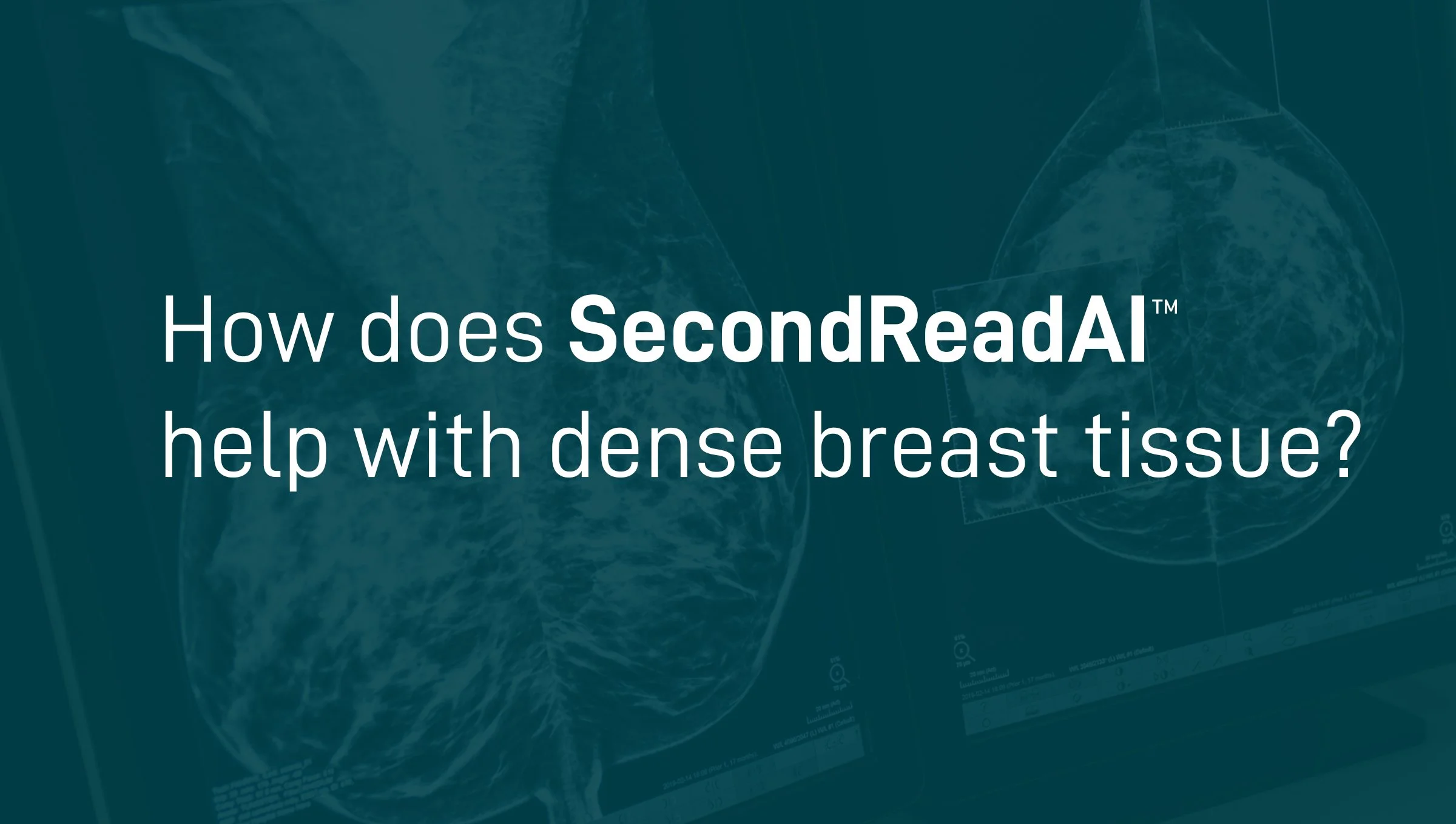 Women's Imaging Services | Second Read | Artificial Intelligence
